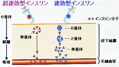 注射 種類 インスリン 名古屋糖尿病内科 アスクレピオス診療院｜名東区の糖尿病専門医